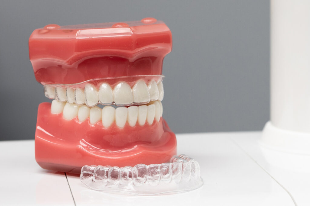 SureSmile® aligners
